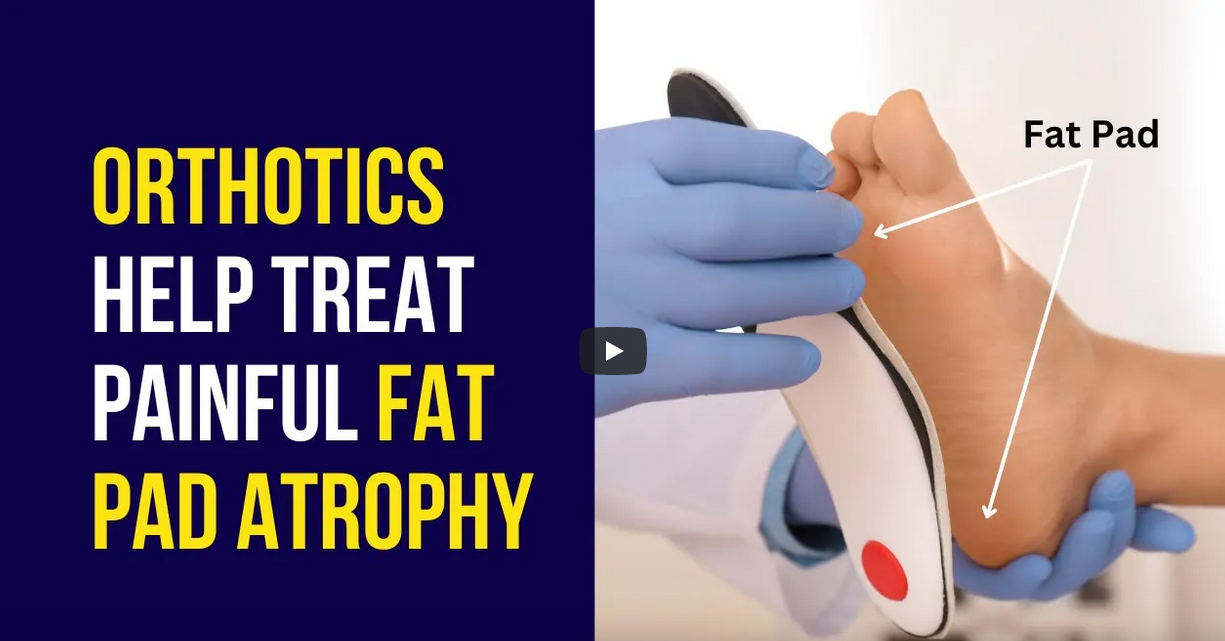 Orthotics Help in Fat Pad Atrophy Treatment Ergonx