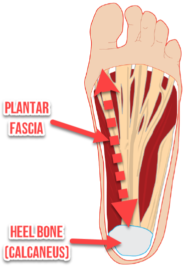 Plantar fasciitis and heel pain occur when the arches collapse and the ligaments are strained in the feet. Orthotic insoles can be effective for pain relief.