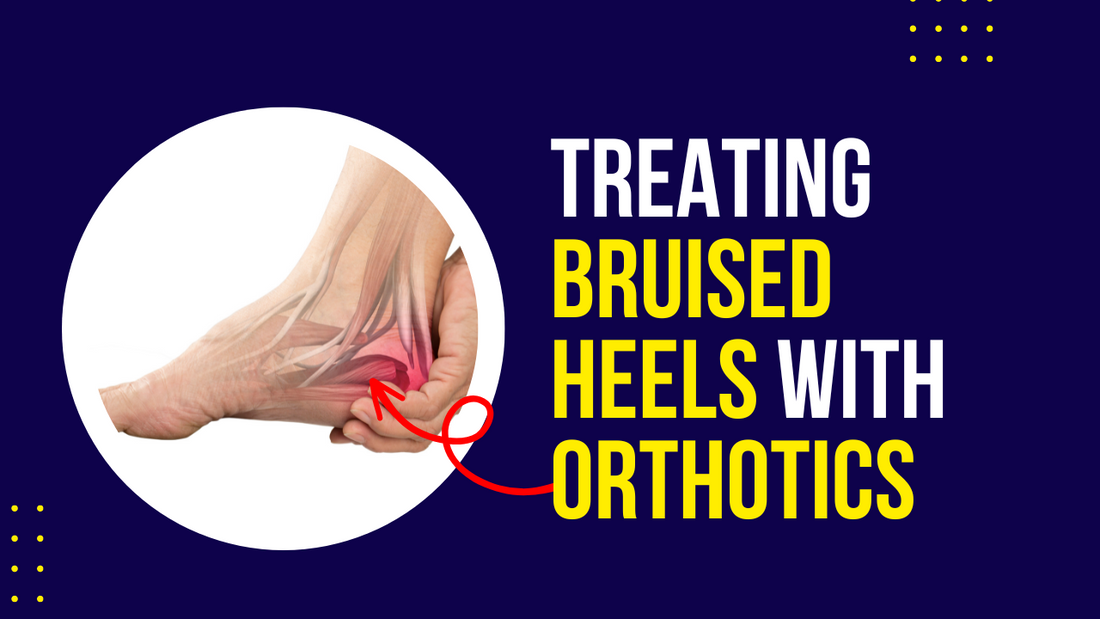 Bruised Heels and How We Treat Them with Orthotics