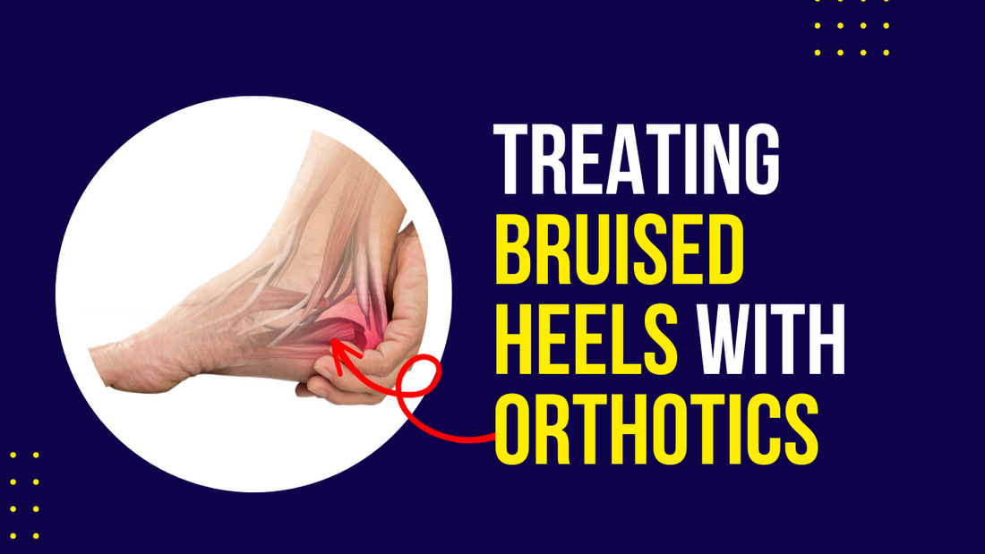 Treating bruised best sale heel