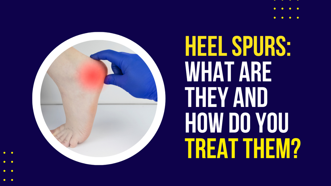 Heel Spurs - What Are They and How Do We Treat Them