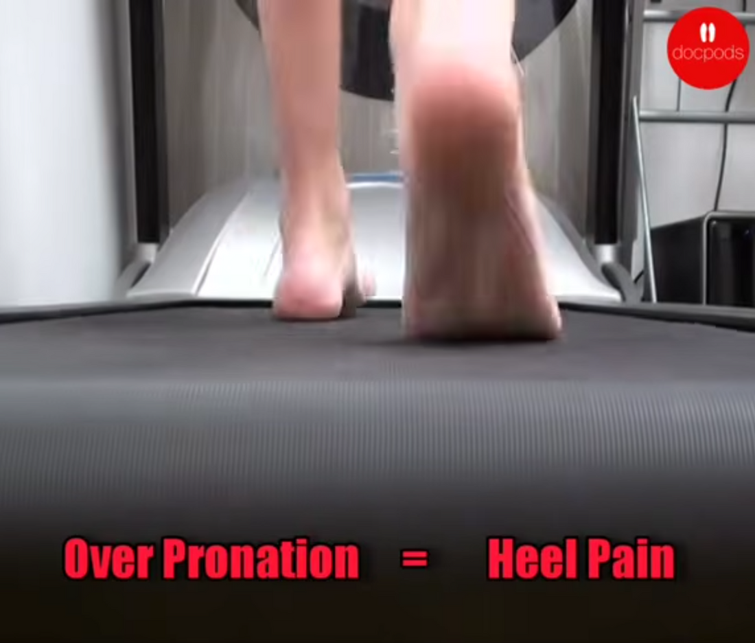 Feeling the burn in your heels? 🦶 It might be from overpronation! Let's dive into ways to ease the