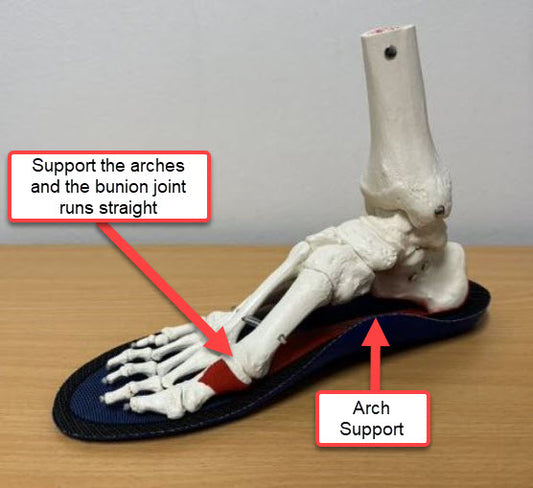 Bunion pain at work - What can be done and Ergonx Ultra Soft Insoles Can Help ?