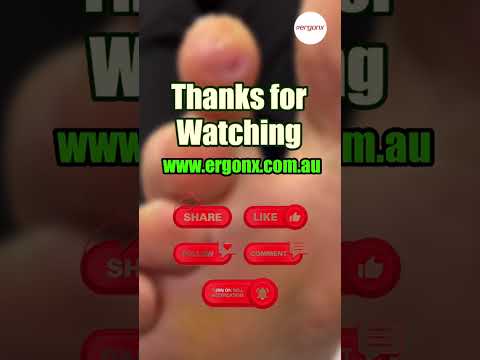 Removing a Corn From the Tip of the Second Toe