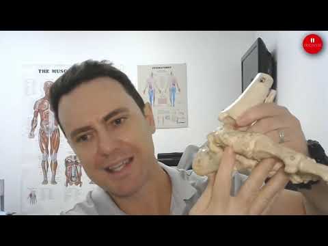 How Orthotics May Help Manage Overpronation