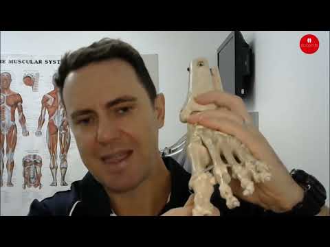 Can Orthotics Help Bunions? How Support Works