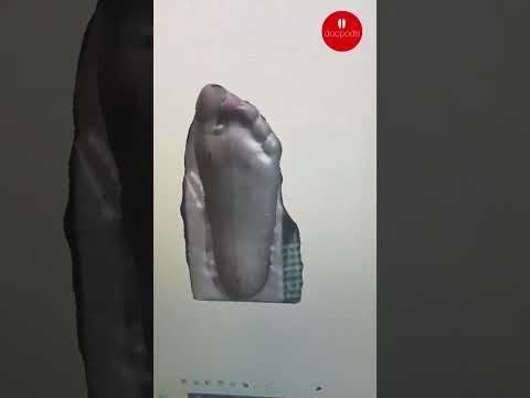 Custom Orthotics from a 3D Foot Scan: How It Works