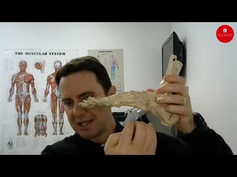 Do Orthotics Help Correct Overpronation?