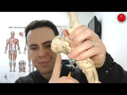 Orthotics for Plantar Fasciitis: A Fit Guide