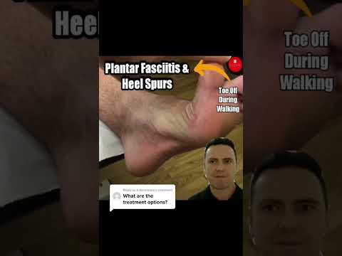 Discover the ultimate relief for plantar fasciitis and heel spurs! From stretching exercises to