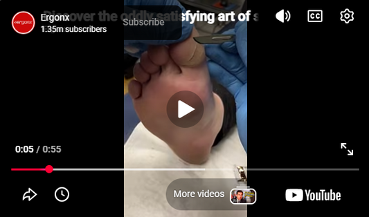 Discover the oddly satisfying art of split big toe skin removal! 🦶✨ Watch how we gently peel away