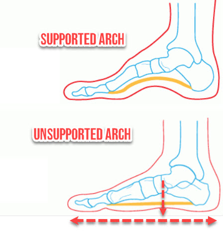 When our arches collapsed they are strained and this can cause aches in the feet