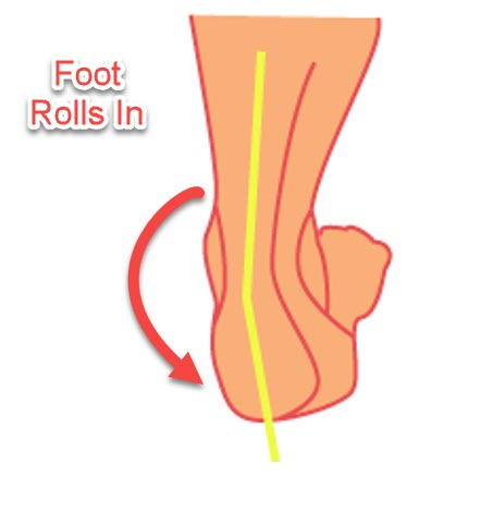 The best insoles for running will help to limit over pronation, fallen arches and load on the feet.